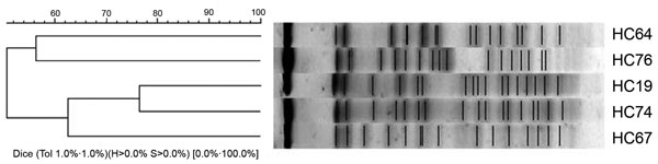 File:E. coli cluster analysis-pulsed-field gel electrophoresis.jpg