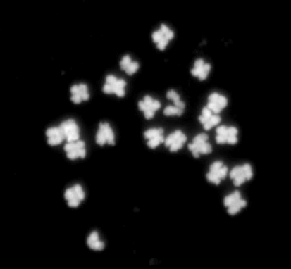File:Karyotype of Common bean (Phaseolus vulgaris).png