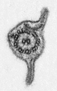 Electron micrograph of "Chilomastix cuspidata". The "9+2" axoneme and the enclosing membrane can be seen, the flagellum has two vanes.