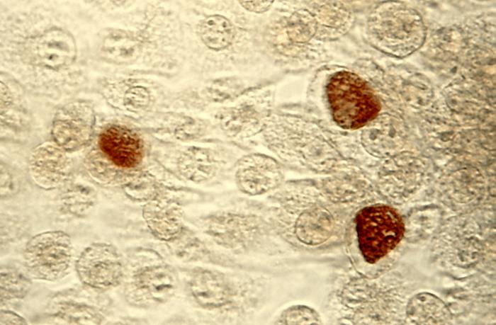File:ChlamydiaTrachomatisEinschlusskörperchen.jpg