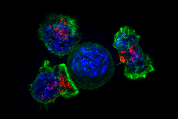 File:Killer T cells surround a cancer cell.png