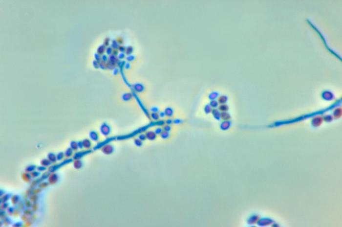 File:Conidiophores and conidia of the fungus Sporothrix schenckii PHIL 4208 lores.jpg