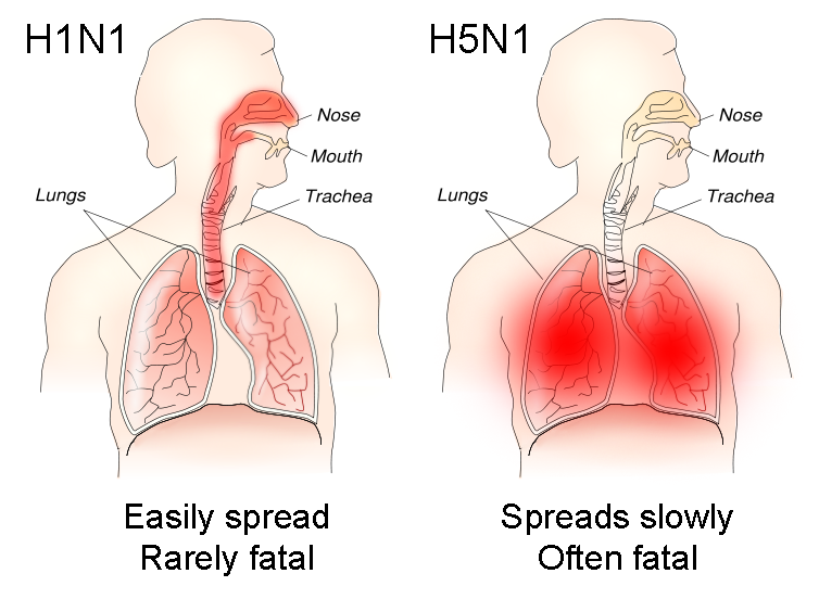 File:H1N1 versus H5N1 pathology.png
