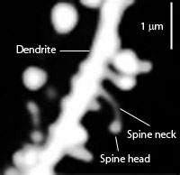 Dendritic spines.jpg