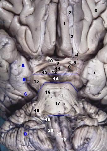 File:Human brainstem anterior view 2 description.JPG