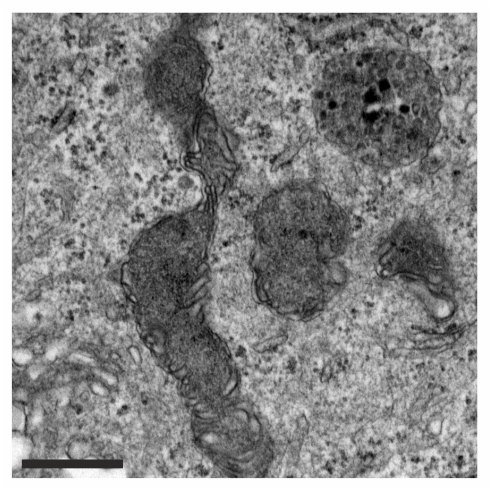 File:TEM image of mitochondria in MEF OMA1-KO after PXA.png
