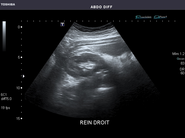 File:Abdominal Ultrasound Full Exam 33.jpg
