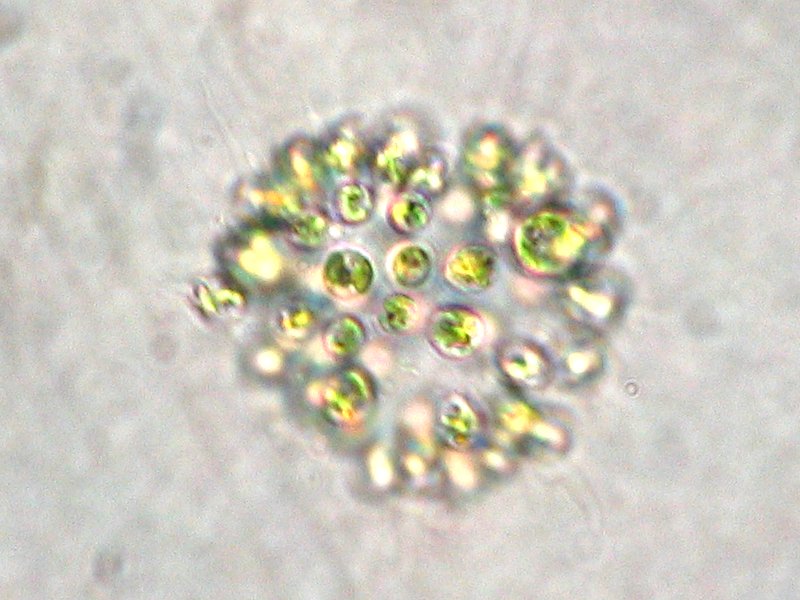 File:Microcystis aeruginosa.jpeg