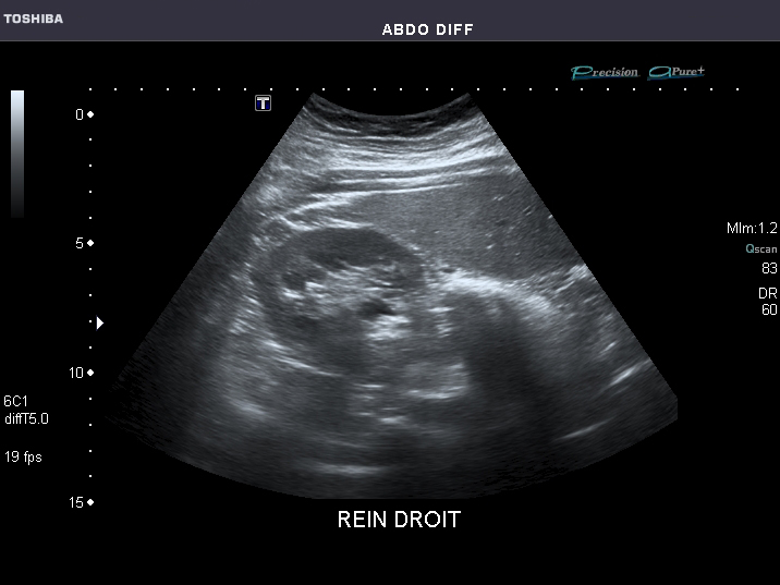 File:Abdominal Ultrasound Full Exam 32.jpg