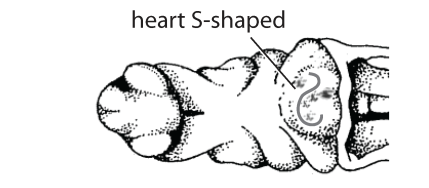 File:J3. Ventricle S-shaped (V10c).png