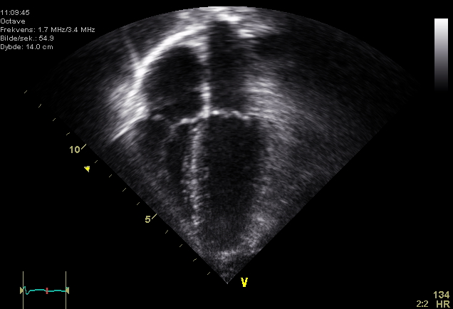 File:Echocardiogram 4chambers.jpg