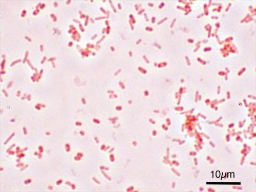 File:Salmonella Typhimurium Gram.jpg