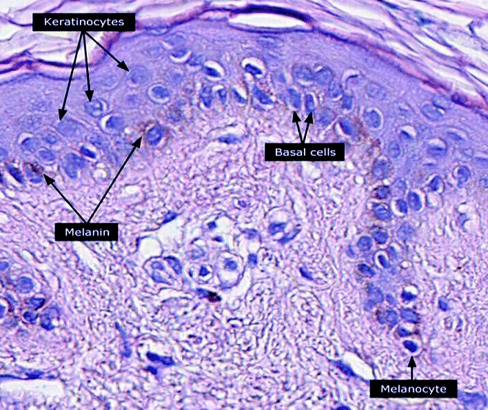 File:Micrograph of keratinocytes, basal cells and melanocytes in the epidermis.jpg
