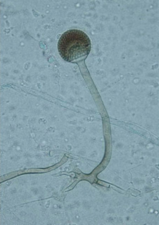 File:Rhizopus microsporus.png