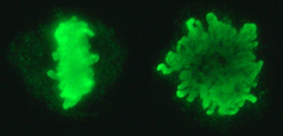 File:Metaphase chromosomes.jpg