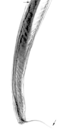 File:Angiostrongylus cantonensis 2.png