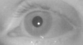 File:Dark pupil by infrared or near infrared illumination.jpg