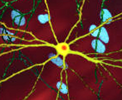 Closer view of neuron having a large central core with several tendrils branching out some of which branch again, the core of the contains an orange blob about a quarter of its diameter