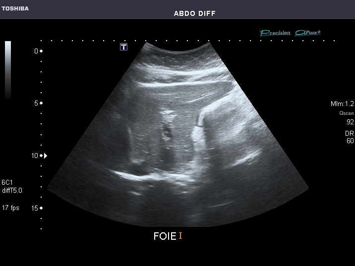 File:Abdominal Ultrasound Full Exam 07.jpg