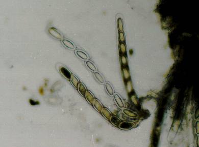 File:Pertusaria paratuberculifera (EU1).jpg