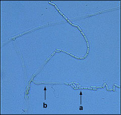 Ceratocystis fagacearum endoconidia.jpg