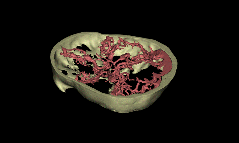 File:Circle of willis from CT angio.gif