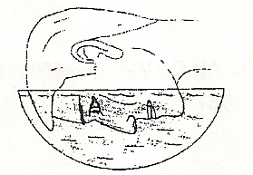 File:Da Vinci's method of corneal neutralization.jpg
