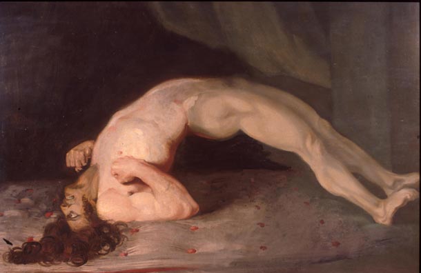 File:Opisthotonus in a patient suffering from tetanus - Painting by Sir Charles Bell - 1809.jpg