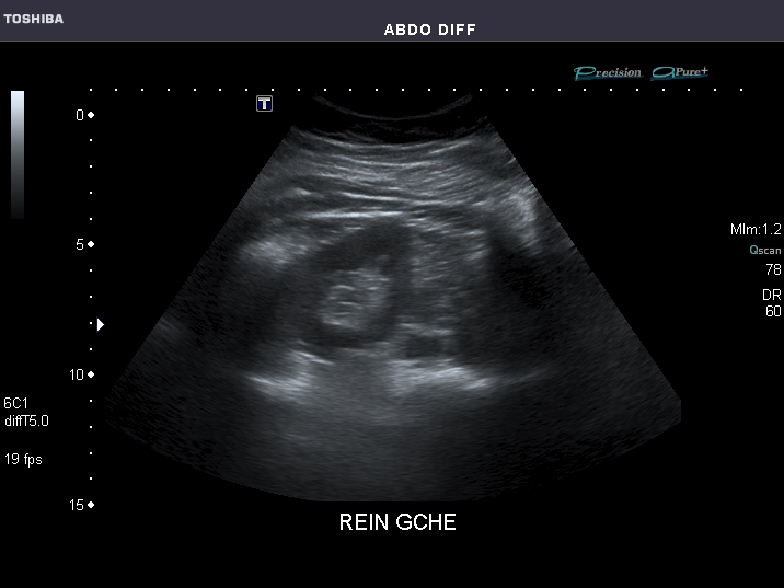 File:Abdominal Ultrasound Full Exam 36.jpg
