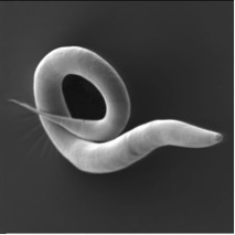 Electron micrograph of ''Caenorhabditis elegans''.jpg