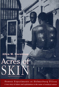 Acres of Skin (book cover).jpg