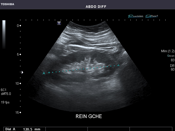 File:Abdominal Ultrasound Full Exam 35.jpg