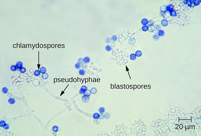 File:Candida pseudohyphae, chlamydospores, blastospores.png