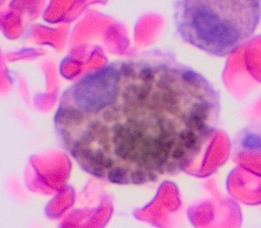 File:Micrograph of a melanophage.jpg