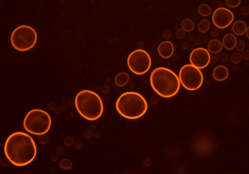 File:Phosphatidylcholine liposomes stained with acridine orange.jpg