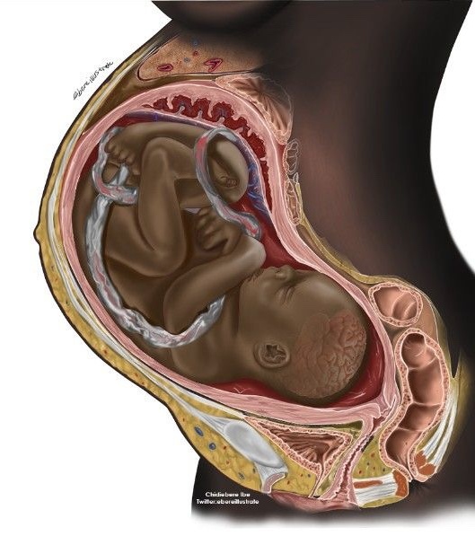 File:PregnancyinCrossSection.jpg