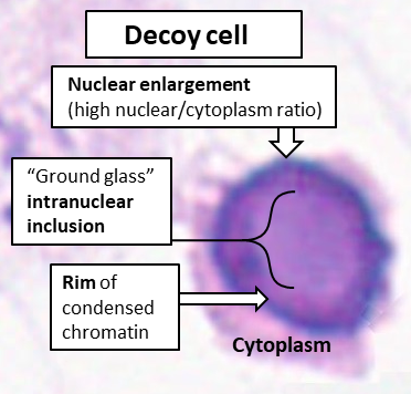 File:Decoy cell on HE stain.png