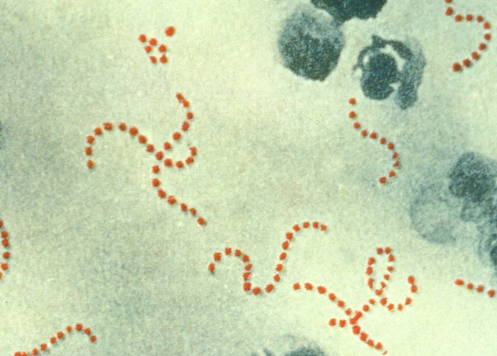 File:Streptococcus pyogenes.jpg
