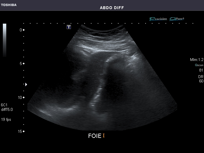 File:Abdominal Ultrasound Full Exam 01.jpg