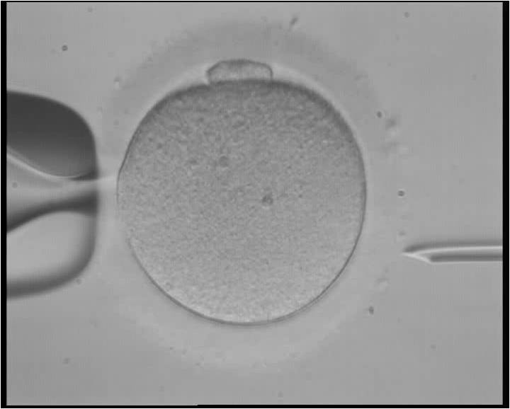 File:In vitro fertilization.jpg