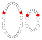 File:Maxillary first molars01-01-06.png