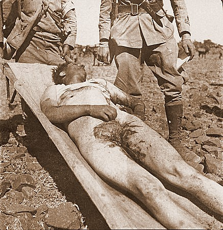 File:Italian military emasculated Second Italo-Ethiopian War.jpg