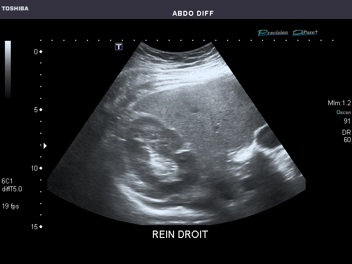 File:Abdominal Ultrasound Full Exam 28.jpg