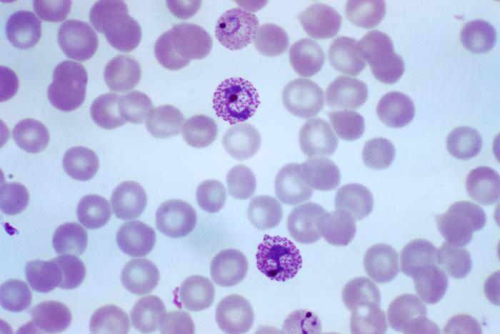 File:Immature and mature trophozoites of the Plasmodium vivax parasite PHIL 2720 lores.jpg