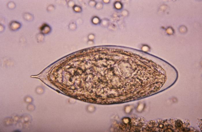 File:Schistosoma haematobium egg 4843 lores.jpg