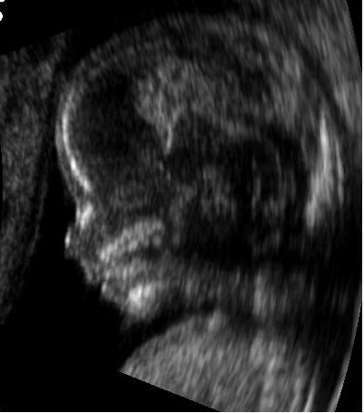 File:Embryo at 14 weeks profile.JPG