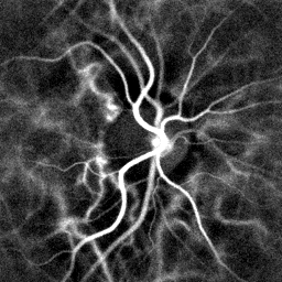 File:Retinal blood flow in the optic nerve head region revealed by laser Doppler imaging by digital holography.gif
