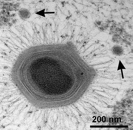 File:Giant Mimivirus with satellite Sputnik virophages.png