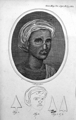 File:Indian method of nose reconstruction, illustrated in the Gentleman's Magazine, 1794.png