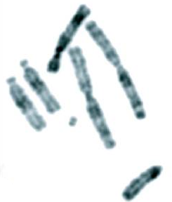 File:Karyotype of Indian muntjac (Muntiacus muntjak).png